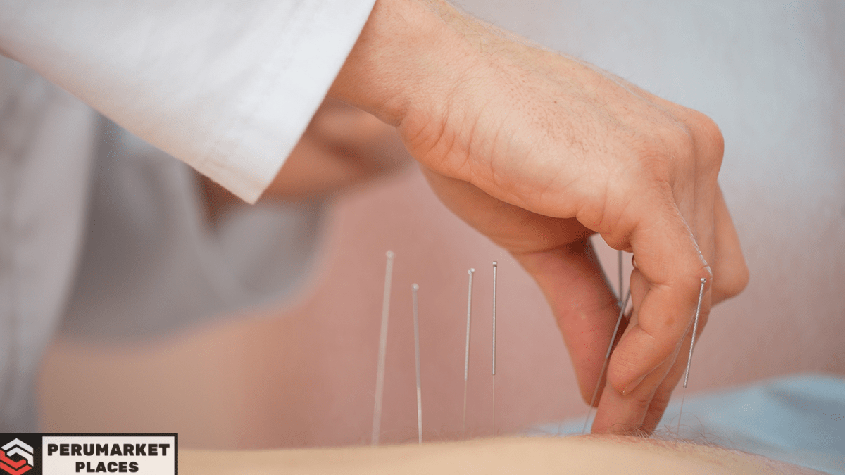 what to wear to acupuncture
